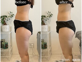 ウル(Ulu)/腸もみビフォーアフター