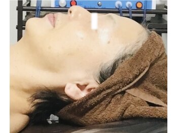 メディカルサロン かとれあ/お客さまのお肌