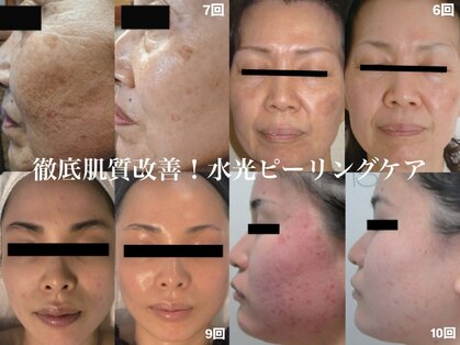 ミューベル(MYubelle)の写真