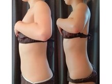 ルナ(Luna)/半身痩身◇3ヶ月