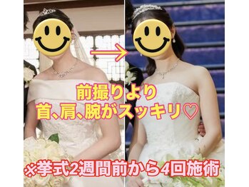 マナリノ(Mana Lino)/最後の駆け込みが大成功!!!