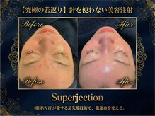 エスポワールカルド(Espoir caldo)