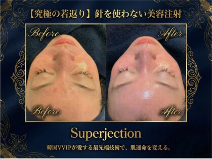 エスポワールカルド(Espoir caldo)の写真