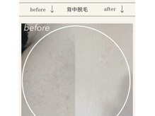 テテアテテ(tete a tete)の雰囲気（【背中脱毛】自分ではお手入れできないからこそプロへお任せ★）