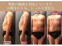 ロベリア(LoveliA)の雰囲気（男性の施術も対応しています。[温活/痩身/よもぎ蒸し/肩こり]）