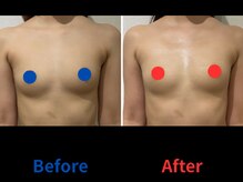 ポインセチア(Poinsettia)/ダイナミックバスト4DX/並び比較