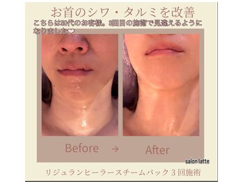 ラテ(latte)/５０代前半のサロンモデル様☆彡