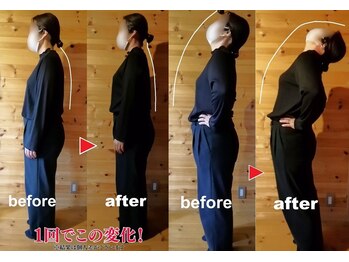 メリッサ接骨 整体院/姿勢、可動域改善お任せ下さい!