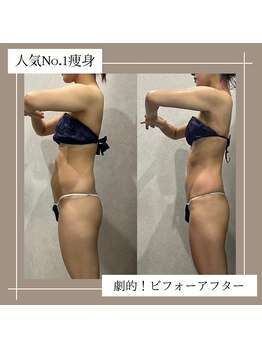 アーネスト 夙川店(EARNEST)/比較写真