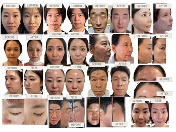 シェリー(Cherie)/【インセルダム】看護師伴走