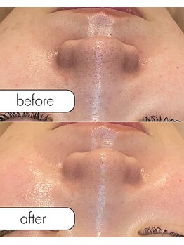 アール(R;)/黒ずみは油分の酸化