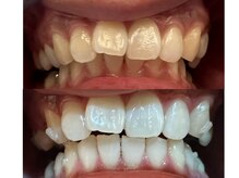 【医療提携】ホワイトニング専門店~Cinderella~の雰囲気(圧倒的効果◎初めての方も、他でで満足されたことがない方も◎)