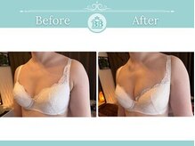 美人バスト 新潟店/ 【バストアップ★育乳】症例