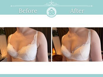 美人バスト 新潟店/ 【バストアップ★育乳】症例
