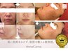【肌をもう一回、立て直したい方へ】お悩みの再確認＋施術リセット 80分～