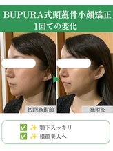 ブプラ 代々木上原店(BUPURA)/小顔×横顔美人へ
