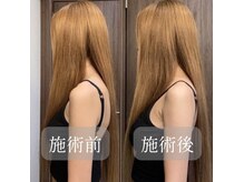 ネイチャー(nurture)の雰囲気(どこに行っても変わらなかった頑固な肩・背中・巻き肩メニュー)