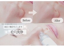 シャロル(SHALOR)の雰囲気(【水光肌】クリスティーナ×毛穴洗浄でワンランク上の仕上がり♪)