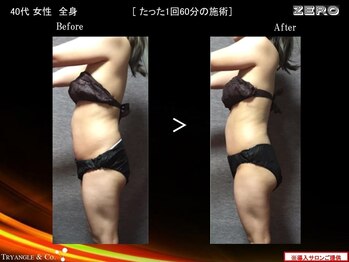 エステサロン ジュレ(JuRER)