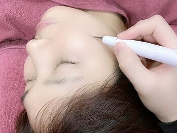 アンリー(ANRE)の写真/【大人のシミケア♪】気になるシミへ徹底アプローチ！お肌への負担を最小限に抑え、すぐにお化粧も可能◎