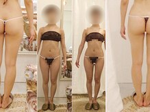 エタ(eta)の雰囲気（痩せるだけじゃ満足できない永続的な美ボディラインを形成。）