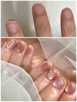 パールズ(PEARLS)/ビフォーアフター(1回)