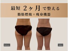 オーク ナチュリ 成城学園前(OAK×NACHUL)/ウエスト引き締め