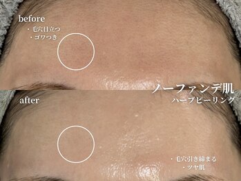 コウル 川西能勢口店(geoul)/毛穴レス美肌コース3回