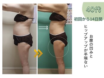 ヨサパーク ミミ 高野店(YOSA PARK mimi)/ビフォーアフター