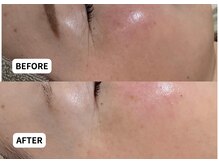 エルナ(Eluna)/美肌覚醒プログラム　セルマン