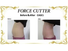 シェリラソワン(Che'rie La Soin)/ビフォーアフター