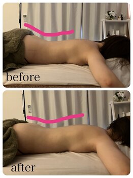 リビーナス(Re.venus)/反り腰改善