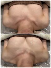 マイントゥー(mine too)/