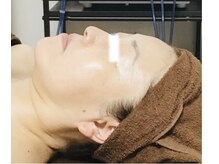 メディカルサロン かとれあ/お客さまのお肌