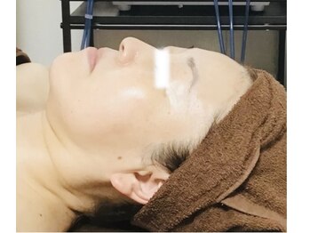 メディカルサロン かとれあ/お客さまのお肌