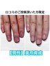 【自爪育成・口コミのご投稿を頂いた男性限定】¥22,000→¥21,000