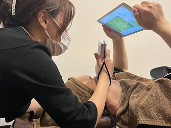 ベベ 大阪中央店(Be’be’)の写真/大満足のビフォーアフター。あなたのお肌に徹底的に向き合います【パーソナル肌管理はお任せください】