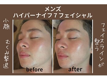 漢方アロマヒーリングサロン 浦和店(漢方AROMAヒーリングサロン)/男性★ハイパーナイフ7