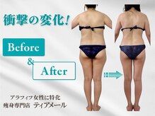 ティアメール