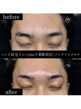 ユー 千葉駅前店(you)/ビフォ－アフター写真