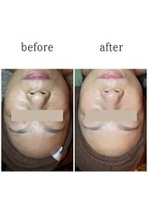 クレアーレ(creare)/ハイライトいらずの肌作り★