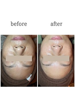 クレアーレ(creare)/ハイライトいらずの肌作り★