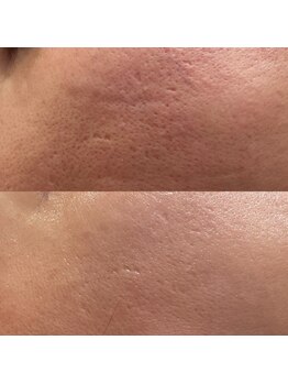 エン(enn)/【毛穴・キメ・ハリ】