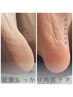 【フット角質ケア】かかと角質しっかりケアのみ¥6000→¥5000　ジェル無し
