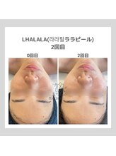 ポムハヌル 大阪梅田中崎町(pom.haneul)/韓国肌管理室