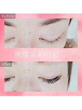 コトリ(kotori)/デザインキープラッシュ