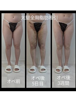 アリビオ(ALIVIO)/美容施術前の大切さ☆