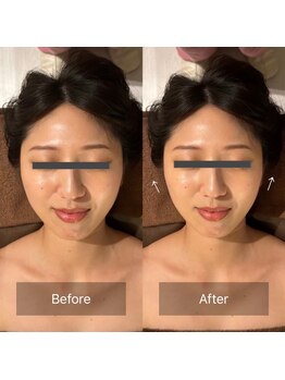 グレースフィオーレ 京橋店(gracefiore)/Before/After( 1回施術)