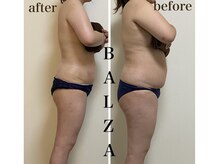 バルザ(Balza)