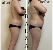 バルザ(Balza)